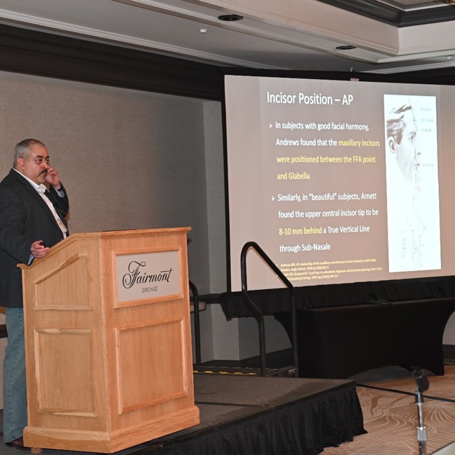 dr vishnu raj orthodontic finishing beginning with the end in mind 